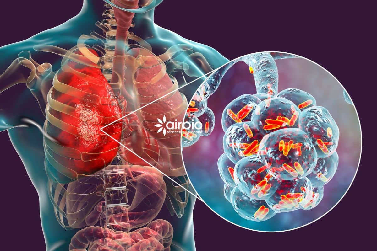Legionella, polmonite da contaminazione impianti idrici